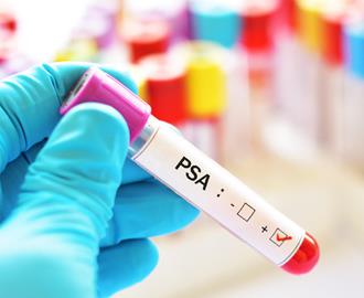 prosztata elemzés